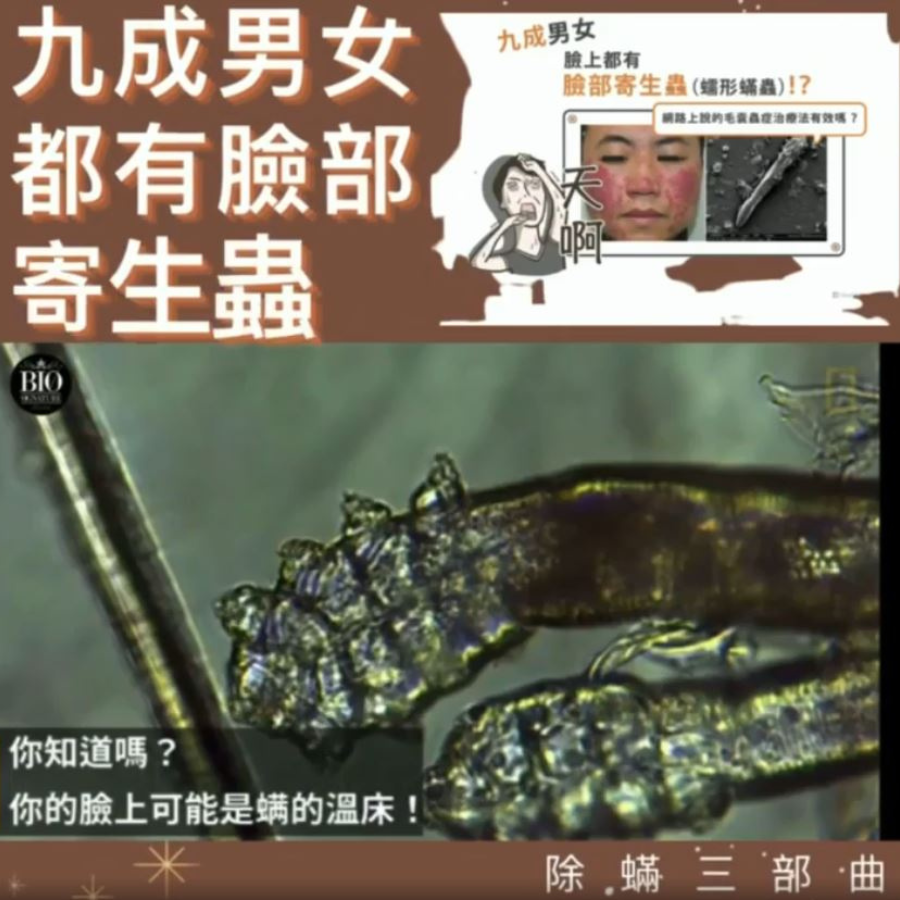 90% 男女臉上都養著一堆蟎蟲😮‍💨